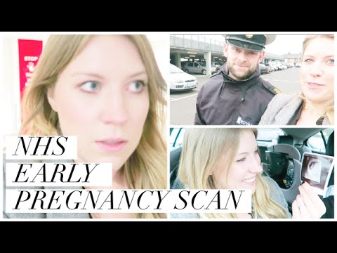 NHS EARLY PREGNANCY SCAN - THREATENED MISCARRIAGE | THIS MAMA LIFE NHS EARLY PREGNANCY SCAN - THREATENED MISCARRIAGE | THIS MAMA LIFE