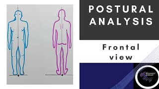 POSTURAL ANALYSIS FRONTAL VIEW FULL BODY  (Posture Biomechanics)Physiotherapy Tutorial