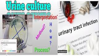 Urinary Tract Infection / عدوي الجهاز البولي