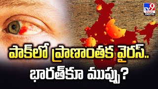 పాక్‌లో ప్రాణాంతక వైరస్‌.. భారత్‌కూ ముప్పు? - TV9