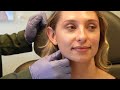 jeuveau treatment step by step many faces of chicago