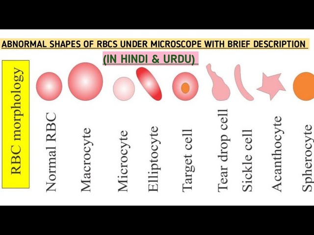 Red Blood Cell Rbc Part Normal Peripheral Blood Smear 49 Off