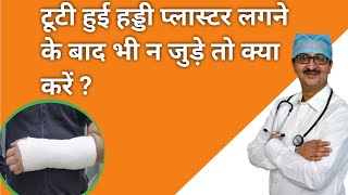 टूटी हुई हड्डी प्लास्टर लगने के बाद भी ना जुड़े तो क्या करें ? #knee_pain #knee_exercise