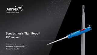 Syndesmosis TightRope® XP Implant