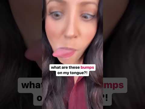 Why is my tongue pale and bumpy?