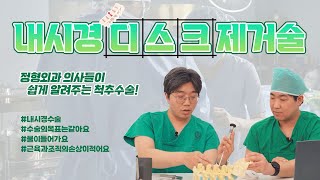 내시경 디스크 제거술은 어떻게 하는 건가요? l 정형외과TV