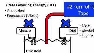 Understanding Gout