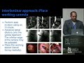 Endoscopic Lumbar Spine Surgery - Christoph P. Hofstetter, MD, PhD