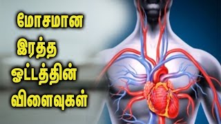 Causes of poor blood circulation || மோசமான இரத்த ஓட்டத்தின் விளைவுகள் - Tamil Health Tips