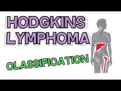 CLASSIFICATION OF HODGKINS LYMPHOMA - TYPES EXPLAINED - YouTube