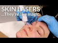 Tight + Bright | An Amazing Combination Laser Treatment | Lucere Skin