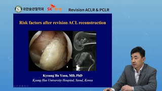 대한슬관절학회 - Revision ACL reconstruction: Various techniques according to previous tunnel - 윤경호 교수