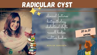 radicular cyst lecture