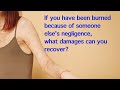 Florida Burn Injury: If you have been burned and scarred, what damages can you recover?