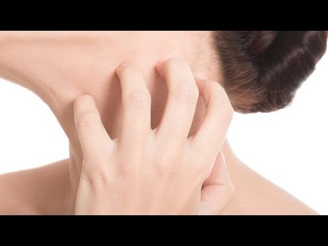 How to Get Rid of Itchy Skin | Itchy Rash How to Get Rid of Itchy Skin | Itchy Rash