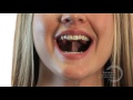 Myofunctional Therapy | Tongue Click and Smile