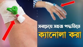 ক্যানুলা করা | খুব সহজ ক্যানোলা করা | IV Line start | IV CANOLA