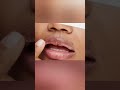 உதடு வெடிப்பு இருக்கா இதை மட்டும் பண்ணுங்க 😲 lip eruption tips