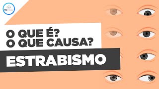 O Que É Estrabismo? E O Que Causa Estrabismo?