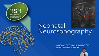 ASA 2022 Melbourne Conference - Neonatal Neurosonography