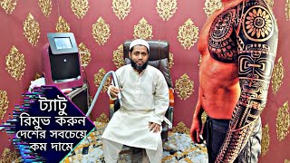 বাংলাদেশের সবচেয়ে কম দামে ট্যাটু রিমুভ করুন | Laser Tattoo Removal Works | Tattoo Remove Shop