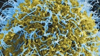 What we still don't know about Ebola