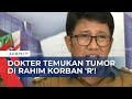 Tim Dokter RSUD Undata Palu Klaim Temukan 6 CM Tumor di Rahim Korban Pemerkosaan 11 Orang