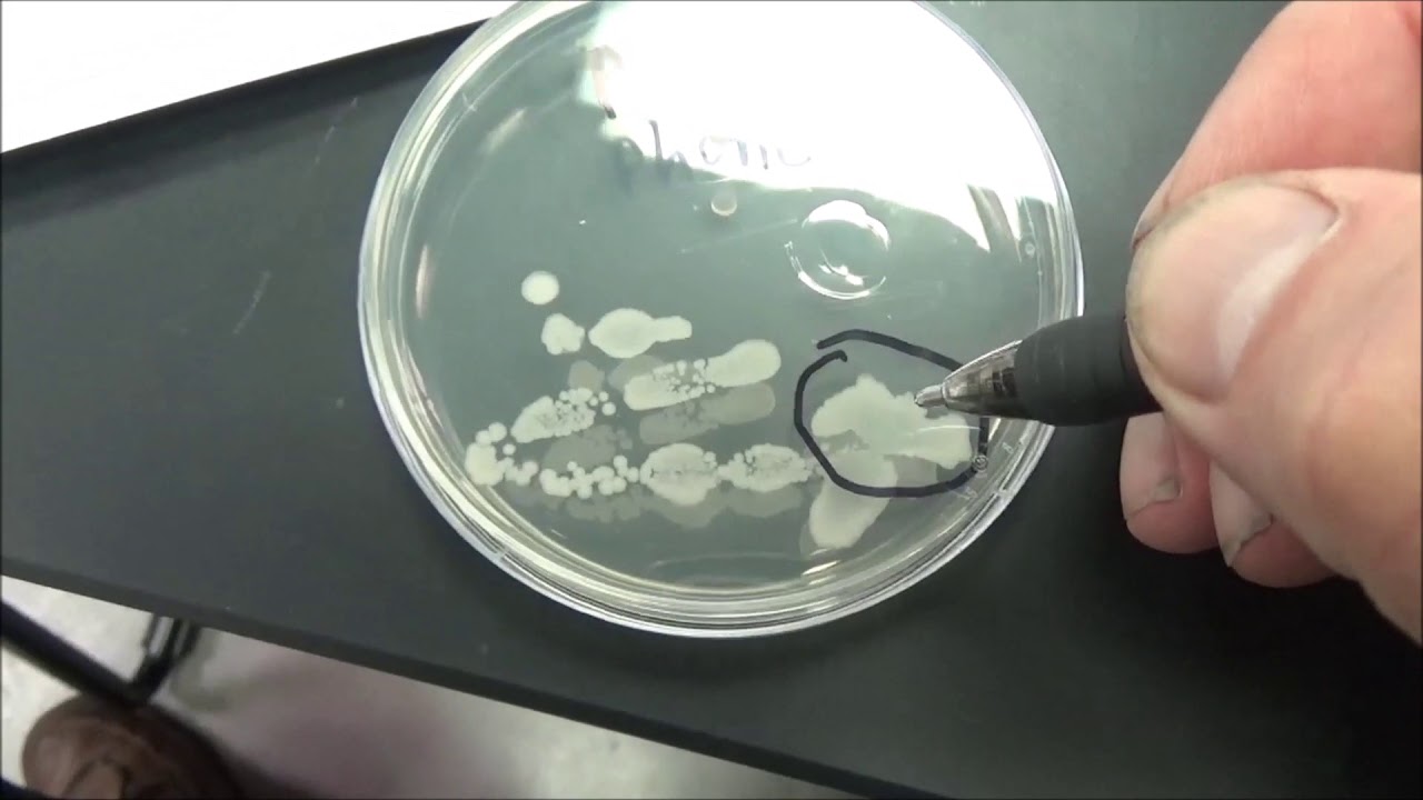 BIOL215L Lab 2 And 3 Unknown Bacteria Culture And Description - YouTube