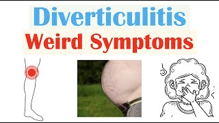 Weird Symptoms of Diverticulitis | Atypical Clinical Features of Diverticulitis