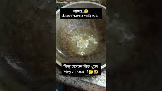 হাসলে দাঁত খুলে পড়ে না কেন 😂😂😜#shorts #short #subscribers #fuunyshorts #vairalshort #everyone