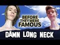 DAMN LONG NECK | Before They Were Famous | INSTAGRAM STAR
