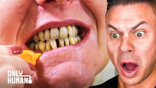 Dentist Reacts to \