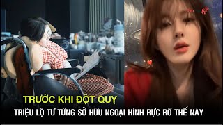 Trước khi đột quỵ ở tuổi 26, Triệu Lộ Tư từng sở hữu ngoại hình khoẻ khoắn và rực rỡ thế này