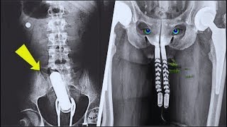 5 Strangest Things Discovered By X-Rays 😳 | facts | facts random
