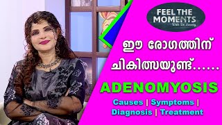 Adenomyosis | Causes | Symptoms | Diagnosis |  Treatment | | ACV | With Dr.Sweety