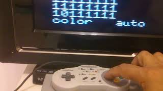 SNES controller read using MSX Basic