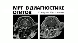 МРТ в диагностике отитов