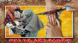 አበሻዋ መዳም ወርቄን ለበሰች ብላ የሰራተኛዋን እጅ ቆረጠች