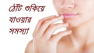 ঠোঁট শুকিয়ে যাওয়ার সমস্যা||Dry Leap||How To Take Care Of Dry Leaps||Health Solution Tips