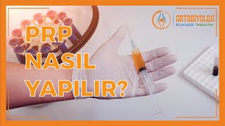 PRP TEDAVİSİ NEDİR? * PRP TEDAVİSİ NASIL YAPILIR?