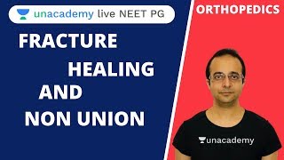 Fracture healing and Non union | Orthopedics | Dr. Mukul Mohindra