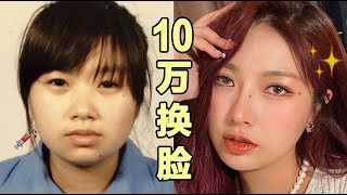 《痣多馨》花10w整容是什么体验