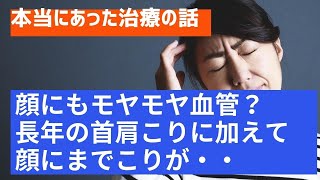 【本当にあった治療の話】顔にもモヤモヤ血管？ 長年の首肩こりに加えて顔にまでこりが