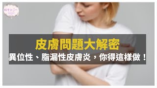 【膚況救星】異位性、脂漏性皮膚炎，皮膚過敏，你得這樣做！｜健康直播精華｜賴宇凡Sara