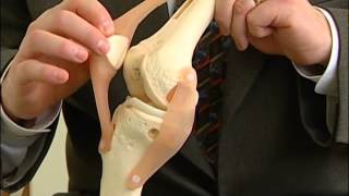 Quadriceps-Sparing Knee Replacement