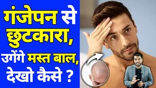 जानिए कैसे गंजेपन से छुटकारा पा सकते है?🤔| A2 Motivation |