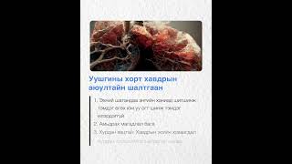 Уушгины хорт хавдрын аюултайн шалтгаан👩‍⚕️Дархлаа дарангуйлах эмчилгээ гэж юу вэ?