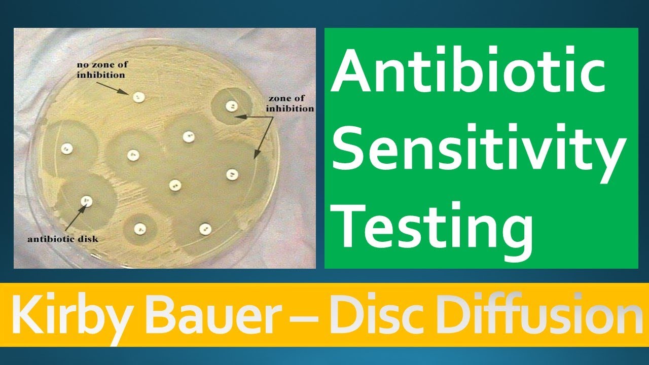 Kirby Bauer - Disc Diffusion Method For Antibiotic Susceptibility ...