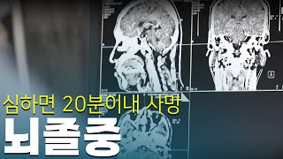 한 해 10만 명 이상 뇌졸중 환자 발생, 이제는 대비해야 할 때 | 건강플러스 | 07월 08일