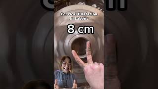 Doctor Explains full cervical Dilatation# pregnancy #labour